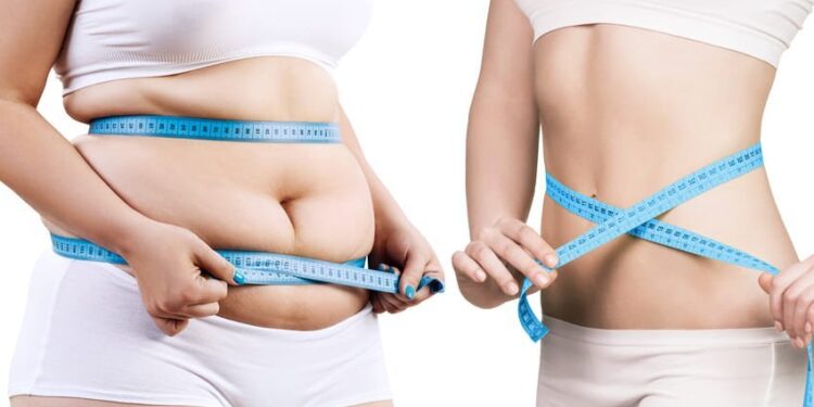 Best liposuction surgeon in India